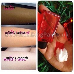 Whitening neck creams for Nigerian men