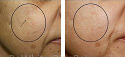 Body cream whitening for Indian women