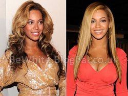 Skin lightening products for Filipino woman