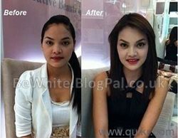 Kojic acid whitening cream for South African woman