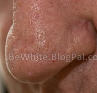 Best whitening creams for Congolese men