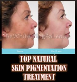 Bleaching skin cream for South African men