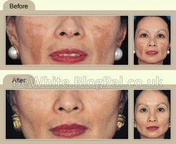Skin care products for Malawian