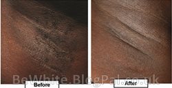 Skin bleaching lotion for Trinidadians