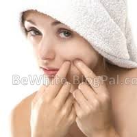 Best skin whitening cream in the world for Somalia