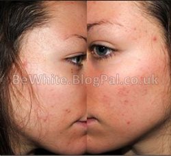 Natural skin lightening cream for Black Africans woman