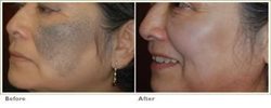 The best whitening cream for Uganda women