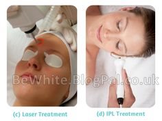 Natural whitening skin for Somali women