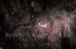 Effective whitening cream for Thai people