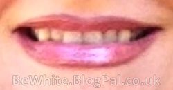 Bleaching your skin for Congo woman