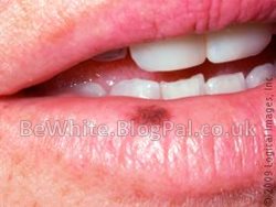 Natural skin lightening products for Malawi women