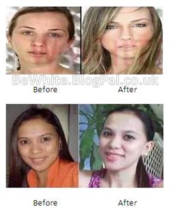 Acne creams for Zambian men