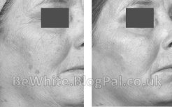 Face whitening for Somalia woman