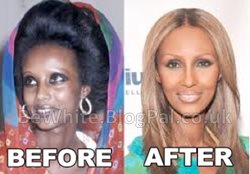 Lightening cream for dark skin