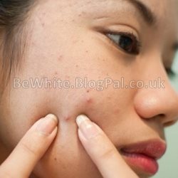 Strong bleaching cream for Somalian people