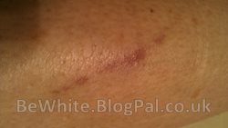 Whitening arm creams for Bangladeshi