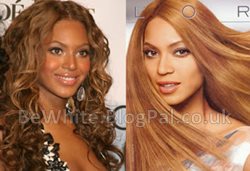 Skin lightening treatments for Ghanaian men