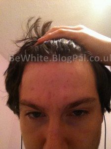 Scar lightening cream for Zambian men