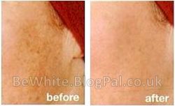 Skin lightening products for Ghanaian people