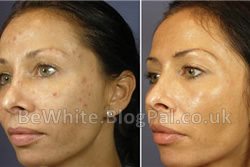 Best skin lightening products for Zimbabwean woman