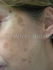 Face whitener for Somalian women