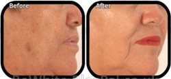 Facial whitening for Pakistani woman