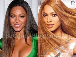 Skin whitening treatment for Malaysian people