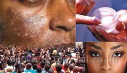 Lightening dark skin creams for Indian woman