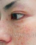 Bleaching arm cream for Filipino woman