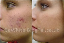 Whitening body cream for Black people