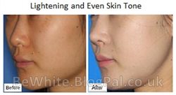 Whitening cream best for Black Africans women