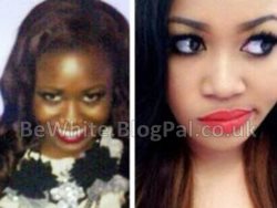 Whitening dark skin creams for Pakistani