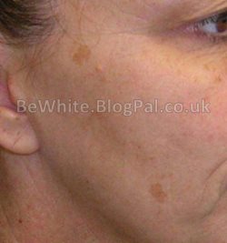 Kojic acid soap for Bangladeshi women