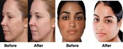 Natural skin whitening tips for Congolese women