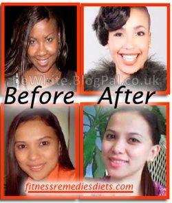 Natural skin lightener for Somali