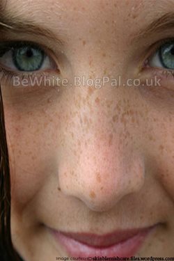 Kojic acid products for Zimbabwean woman