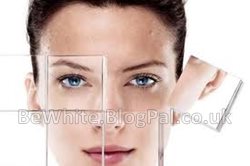 Skin bleaching lotion for Bangladeshi