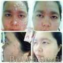 African bleaching cream for Black