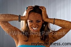 Lightening face cream for Uganda men
