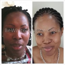 Skin lightening serum for Asian woman