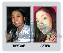 Body cream whitening for Malawi women