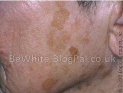 Skin lightening facial for Indian