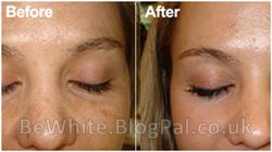 Body whitening creams for Africans people
