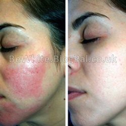 Natural skin whitening tips for Zambia