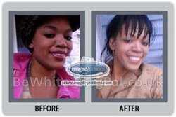 Whitening cream best for neck