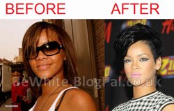 Natural skin bleaching for dark skin
