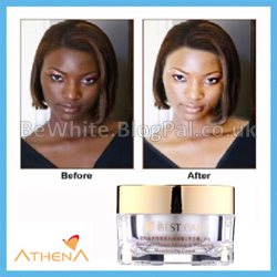 Acne cream for Zambia people