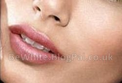 Hyperpigmentation creams for Jamaican men