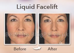 Face whitening cream for Zimbabwe women