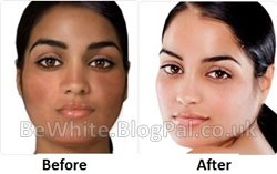Skin whitening facial for Somalian